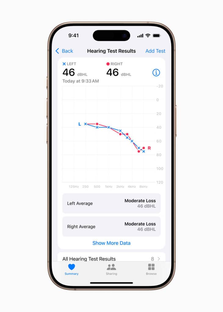 Apple health Hearing Test results summary 240909