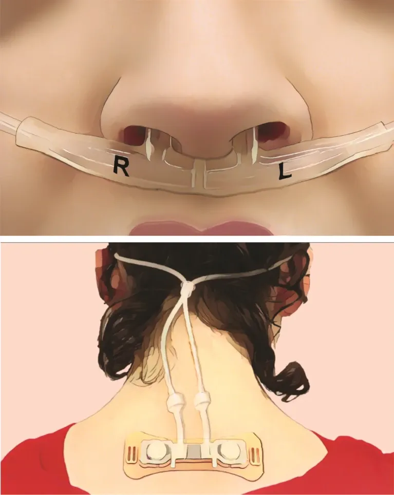 nasal holter 1